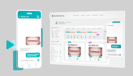 Dental Monitoring